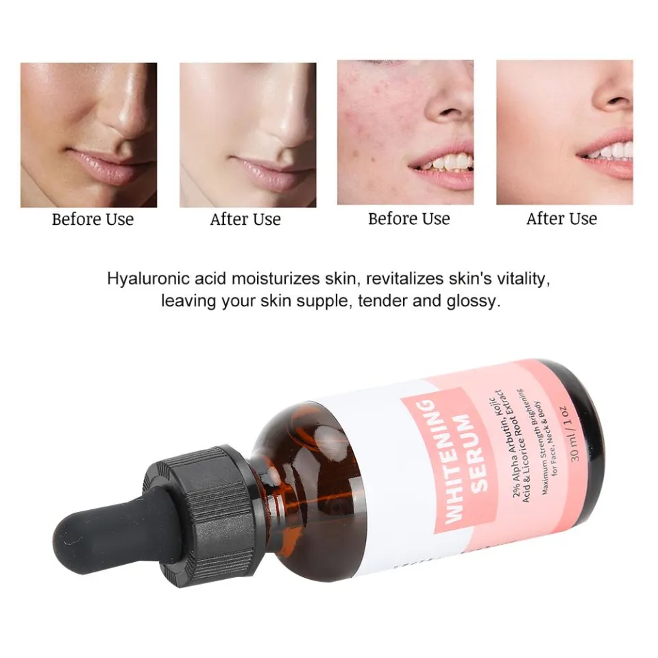 MELAO Organic Skin Moisturizing Acid Essence Whitening Lightening Serum-30ml
